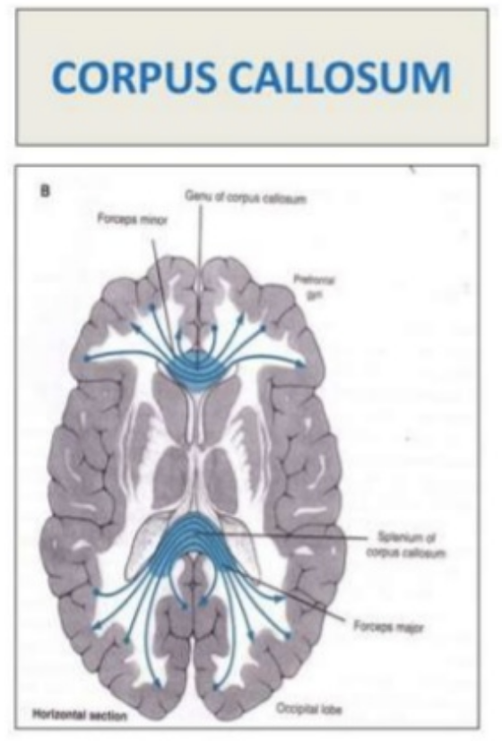 split-brain-a-love-story-artsengine